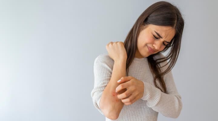 Cumberland Blog — Is it Dry Skin...Or Something Else?