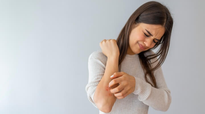 woman scratching her arm