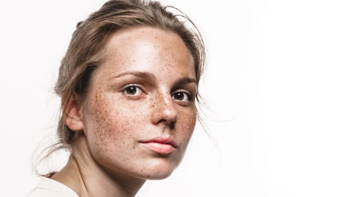 serious woman with freckles on face